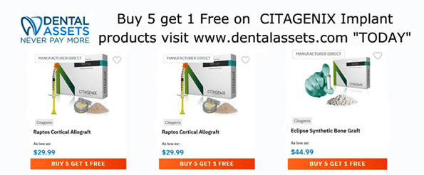 Incredible Implant Product Deals!